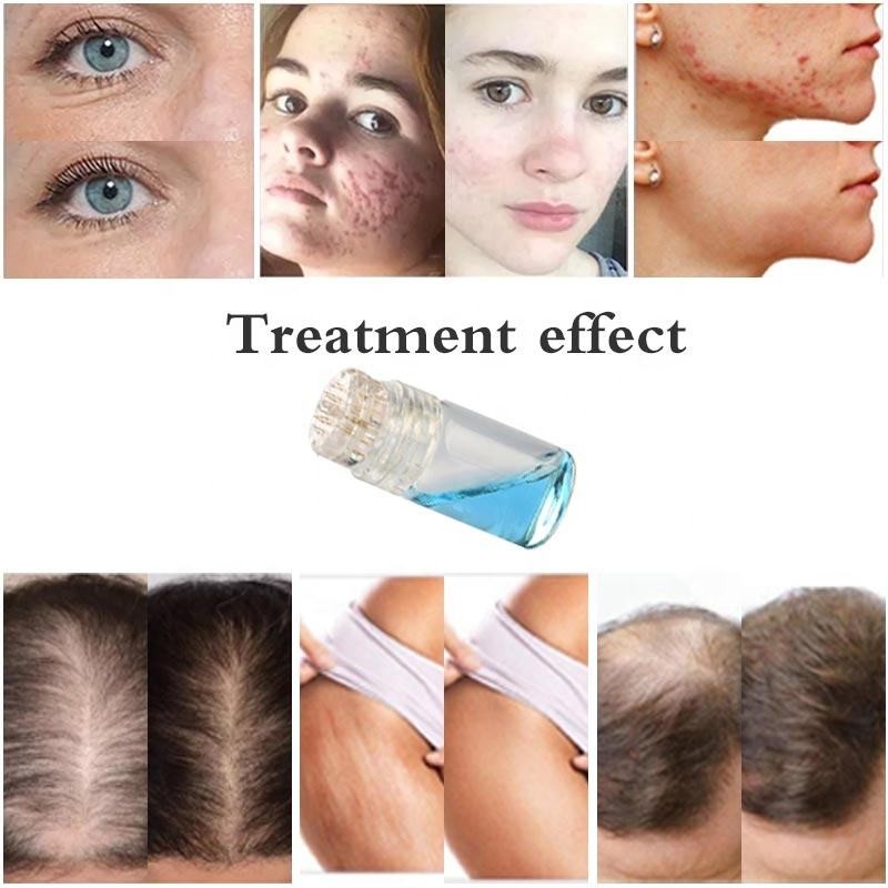 Microneedling Stamp Factory - All in One Hydra Needle Device