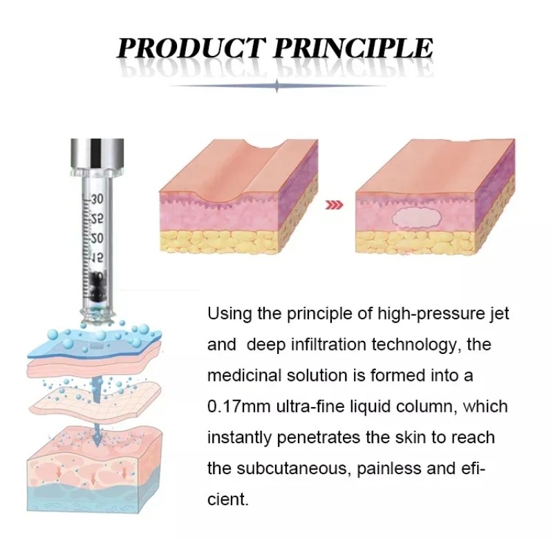 Lip Plumper Device Supplier - Electric Hyaluronic Acid Lip Plumper