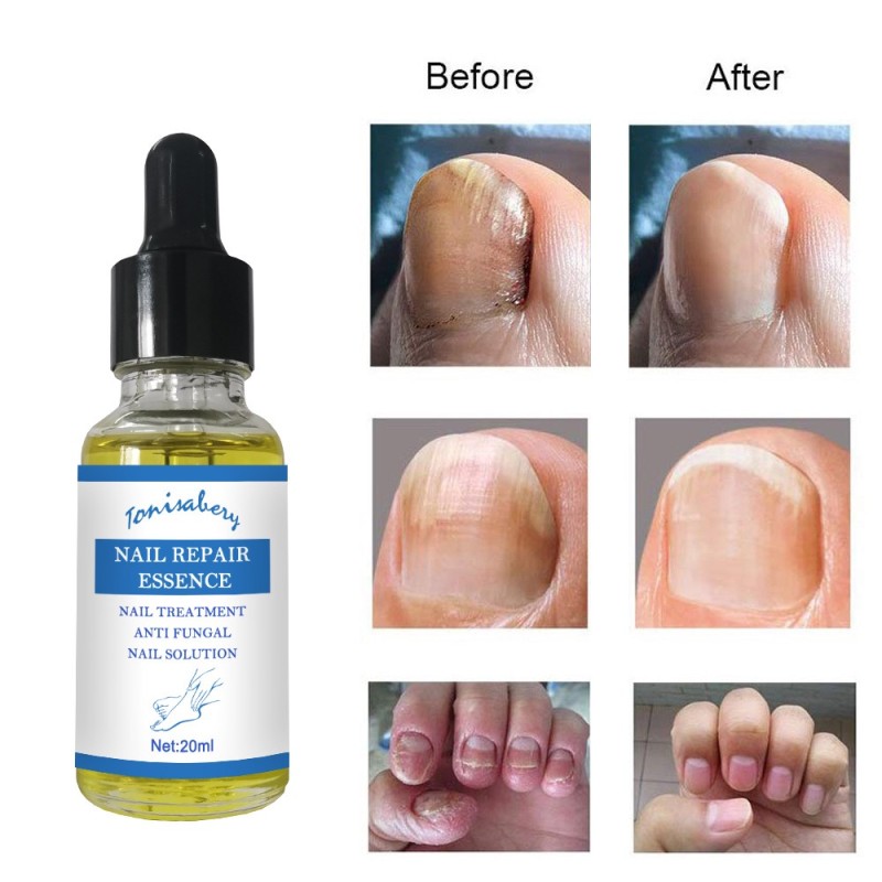Nail Care Serum Supplier - Tonisabery Moisturizing Soft Nail Care Nail Repair Serum
