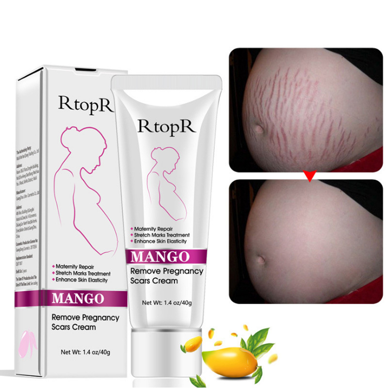Skin Care Cream Supplier - Body Skin Repair Remove Clear Pregnancy Scar Removal