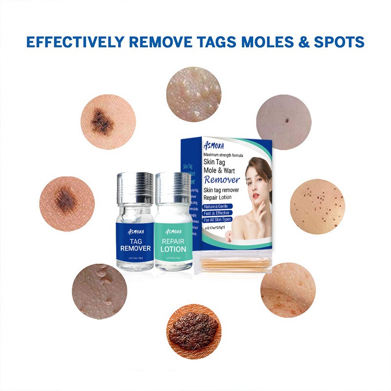 Mole Remover Factory - Painless Mole Skin Dark Spot Removal Face Wart Tag Cream