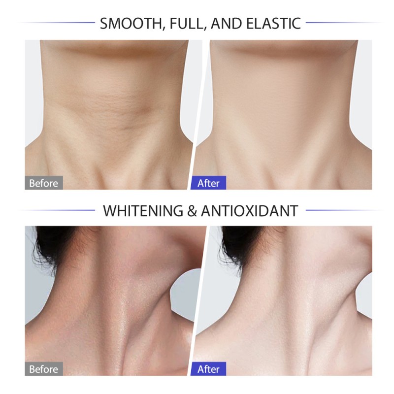 Neck Cream Manufacturer - MOIKA High Quality Neck Firming Cream Moisturizing Anti Wrinkle