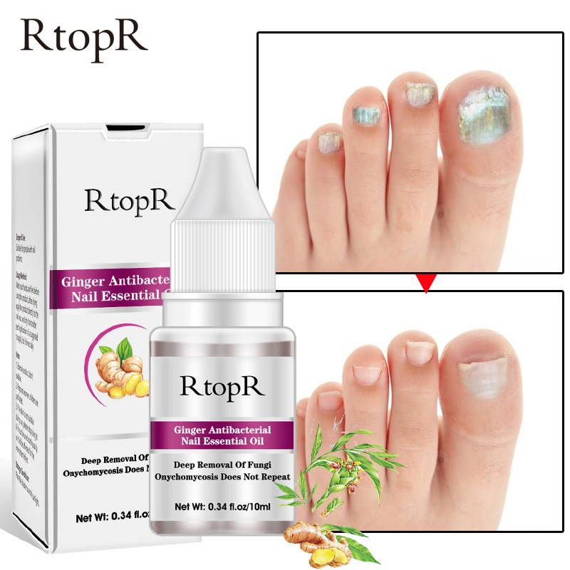 Nail Treatment Supplier - Wholesale Natural Herbal Fast Strong Effect Onychomycosis