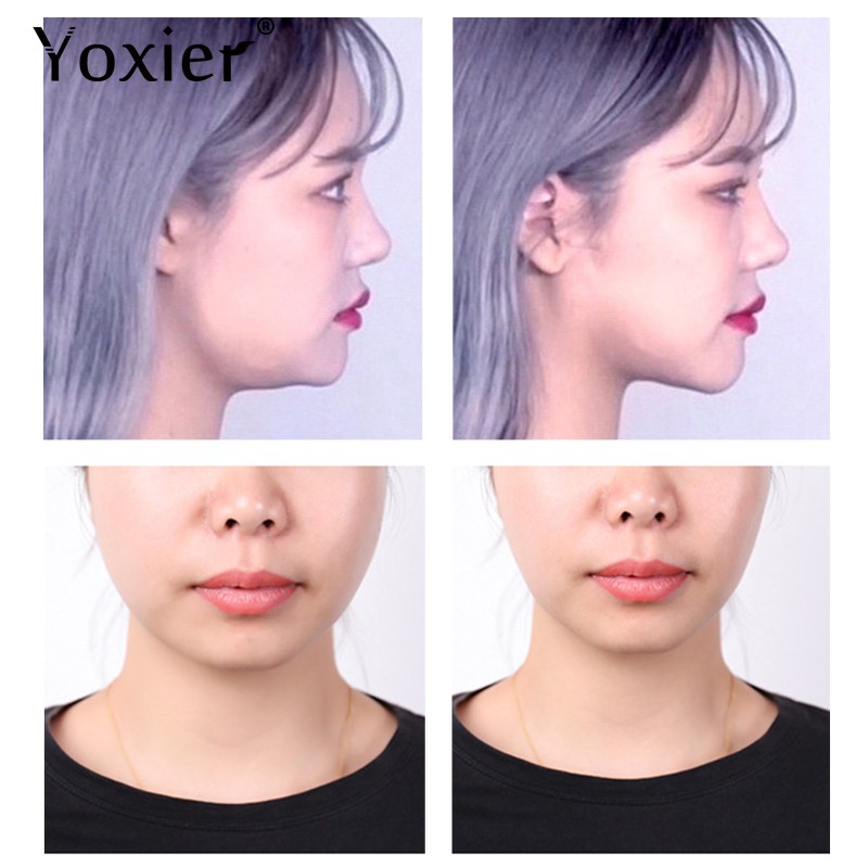 Face Lift Tape Manufacturer - Invisible V-shape Thin Tape for Tighten Skin Face Chin