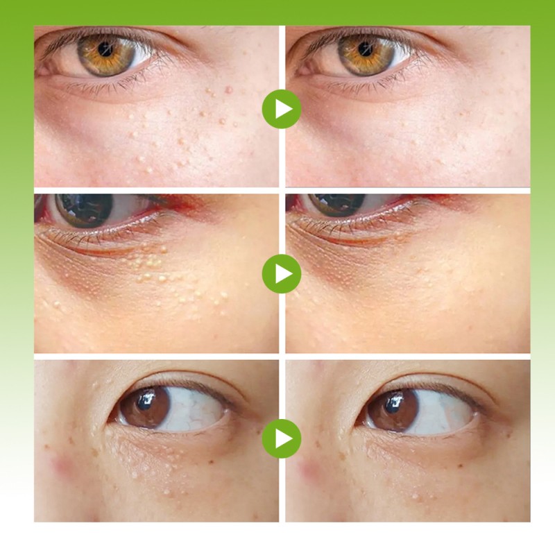 Eye Cream Manufacturer - Skin Care Beauty Eye Cream Anti Aging Repairing Eyes Care