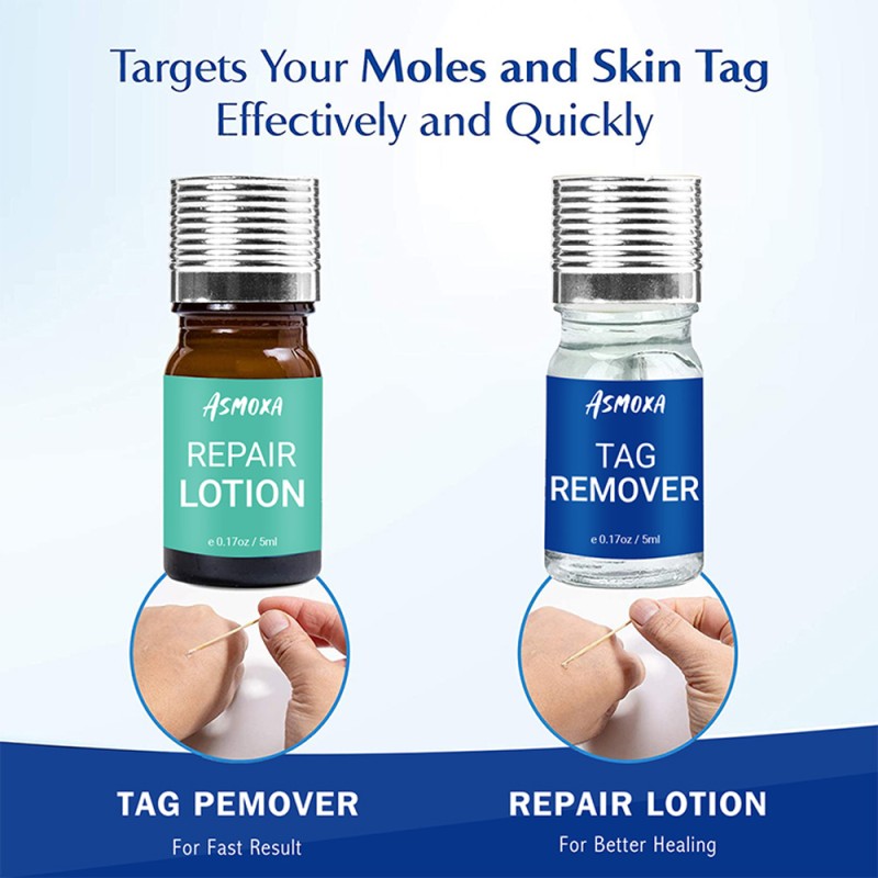 Mole Remover Factory - Painless Mole Skin Dark Spot Removal Face Wart Tag Cream