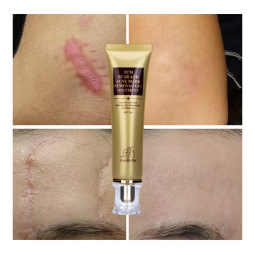 Scar Removal Cream Supplier - Scar Remove Gels Professional Effective Cream Relief Acne Mark