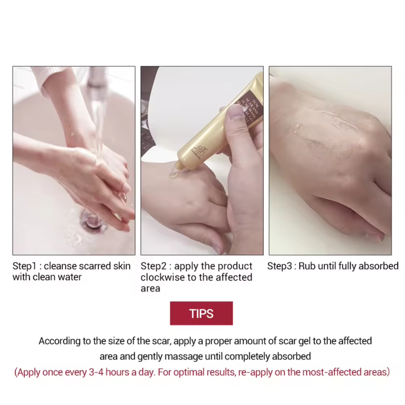 Scar Removal Cream Supplier - Scar Remove Gels Professional Effective Cream Relief Acne Mark
