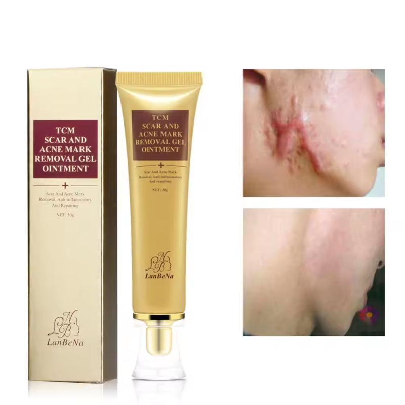 Scar Removal Cream Supplier - Scar Remove Gels Professional Effective Cream Relief Acne Mark