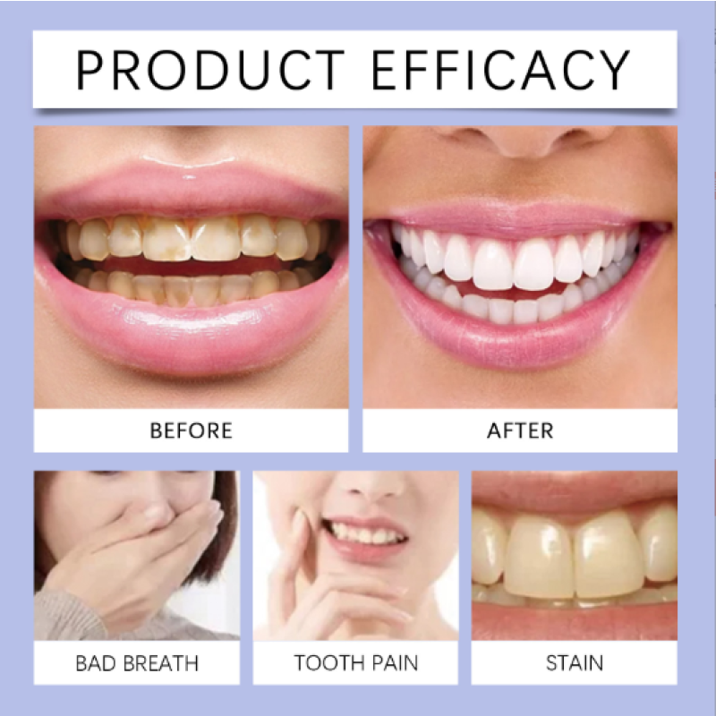 Teeth Whitening Pen Manufacturer - 4pcs White Teeth Whitening Pens Remove Stains Mint Flavor