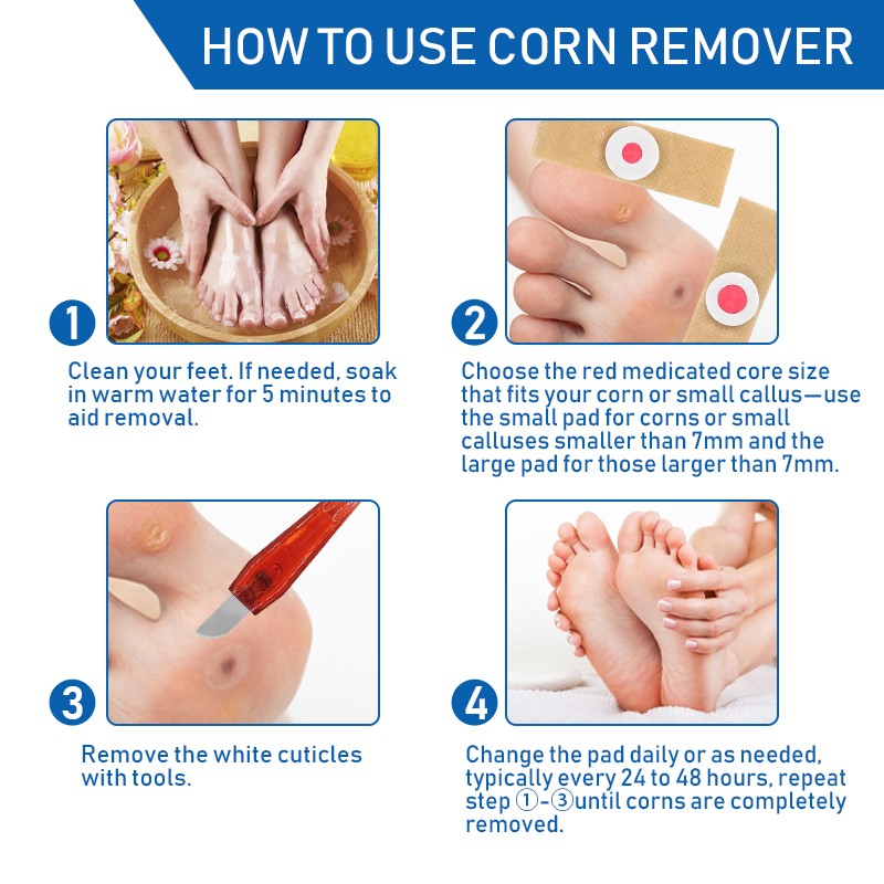 Corn Remover Patch Supplier - Neutralize Excess Salicylic Acid Reduce Rubbing Corn Remover