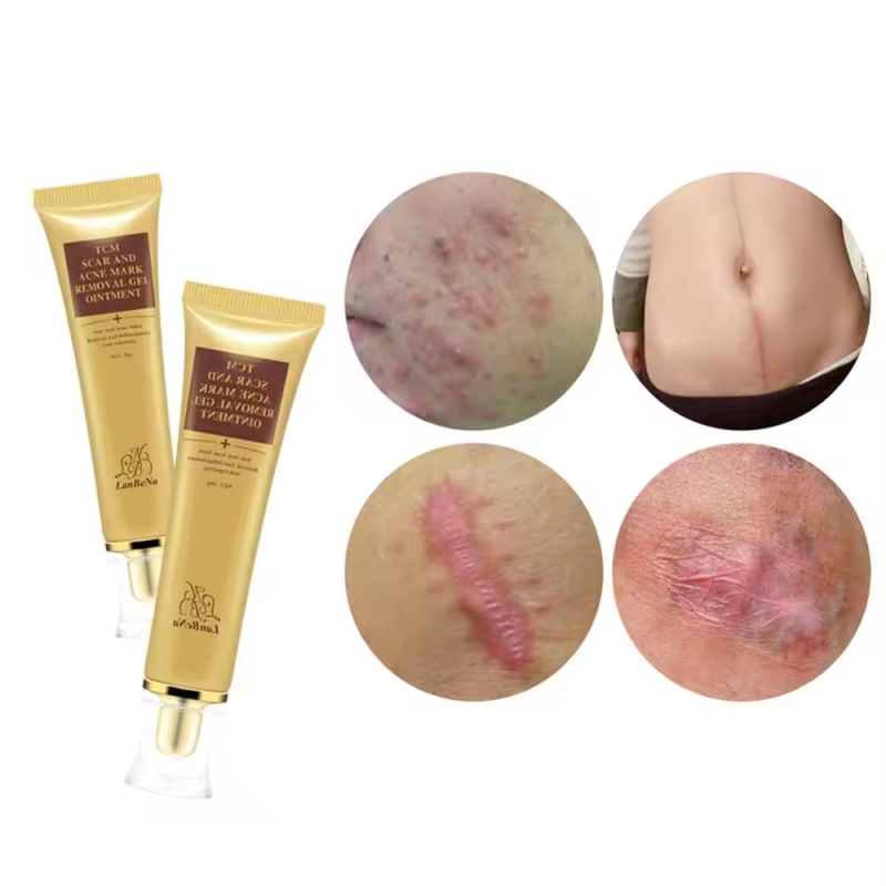 Scar Removal Cream Supplier - Scar Remove Gels Professional Effective Cream Relief Acne Mark