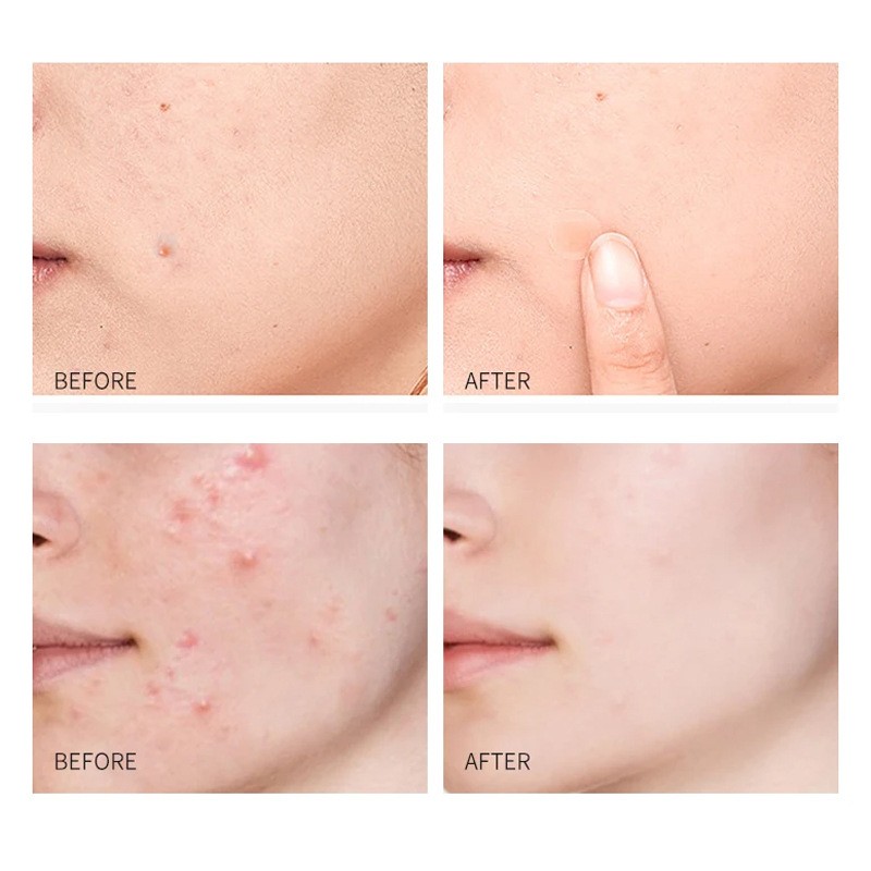 Herbal Patch Manufacturer - Shoulder Neck Pain Relief Steam