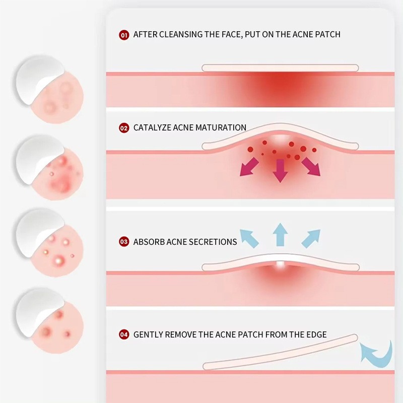 Herbal Patch Manufacturer - Shoulder Neck Pain Relief Steam