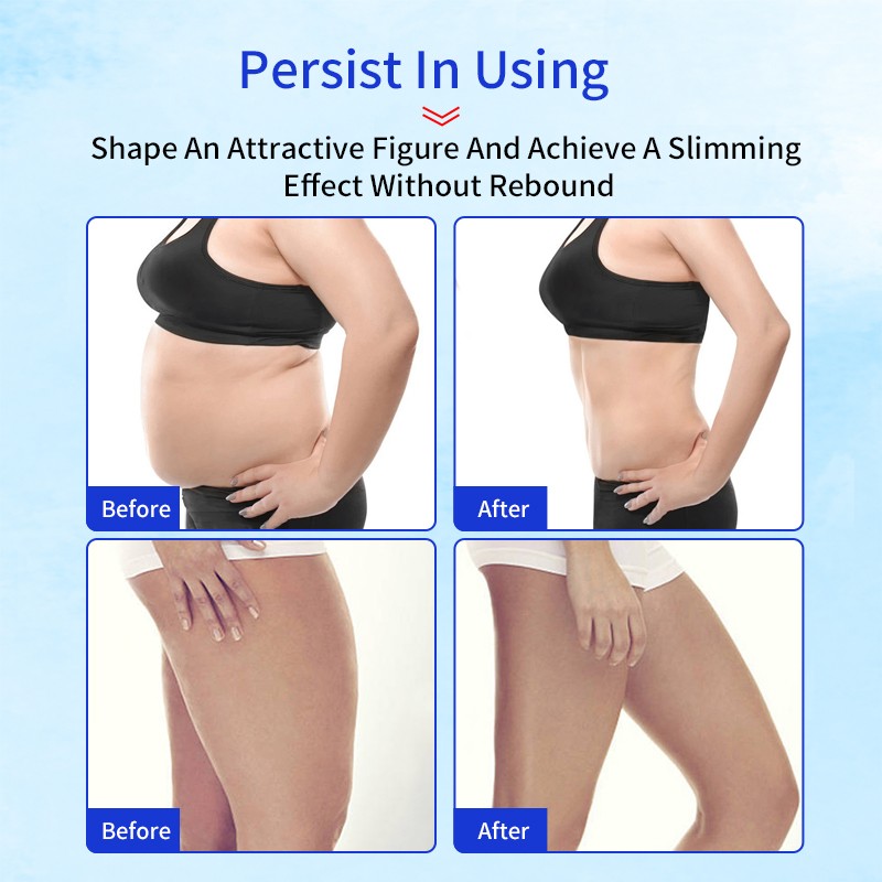 Slimming Cream Manufacturer - OEM Private Label Flat Stomach Slimming Cream Fat Burning Massage Gel