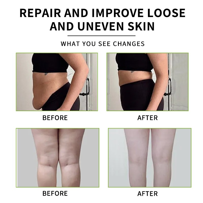 Body Slimming Cream Supplier - Professional Body Slimming Massager Cream Abdomen Firming Fat Burning