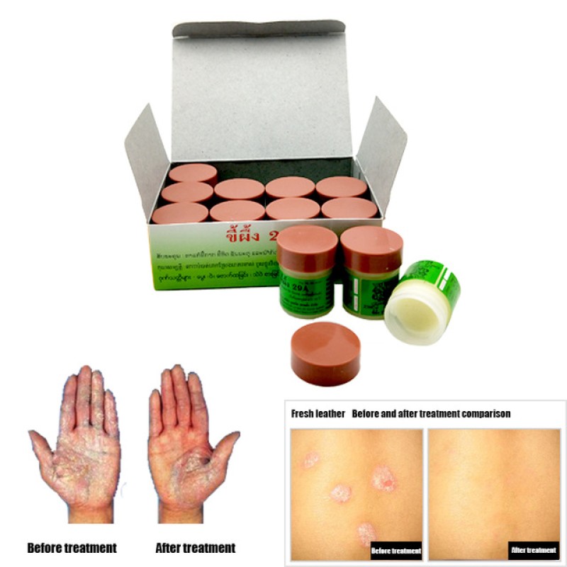 Herbal Ointment Factory - Natural Dermatitis Psoriasis Pruritus Cream