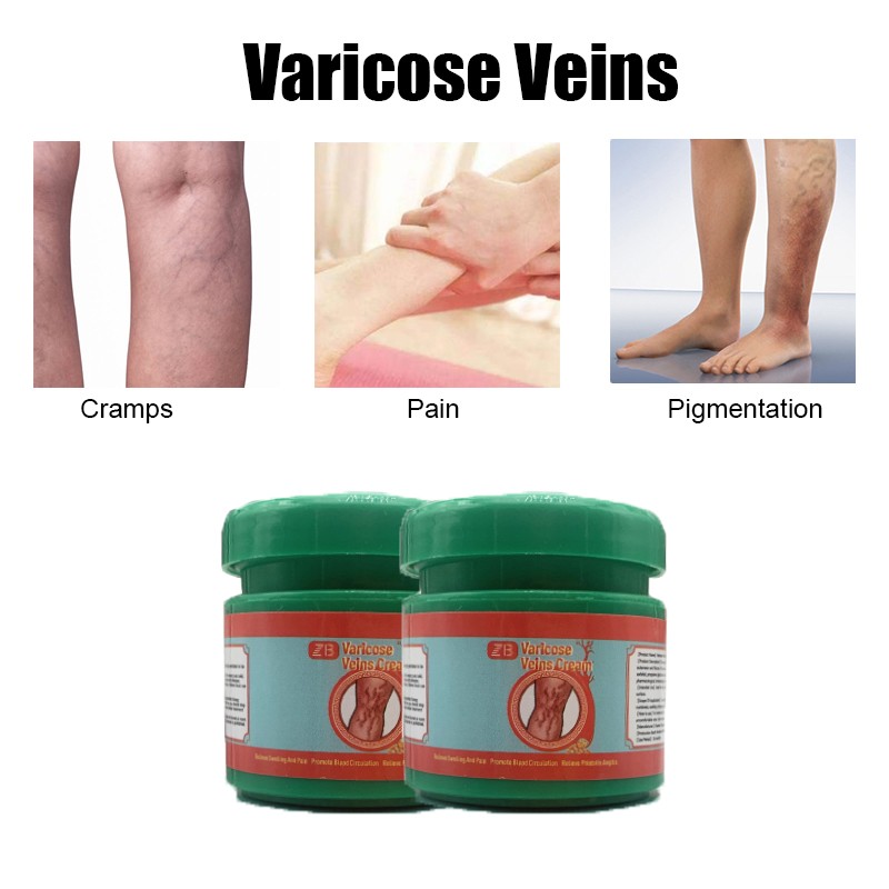 Varicose Vein Cream Manufacturer - Natural Herbal Leg Pain Care 20g