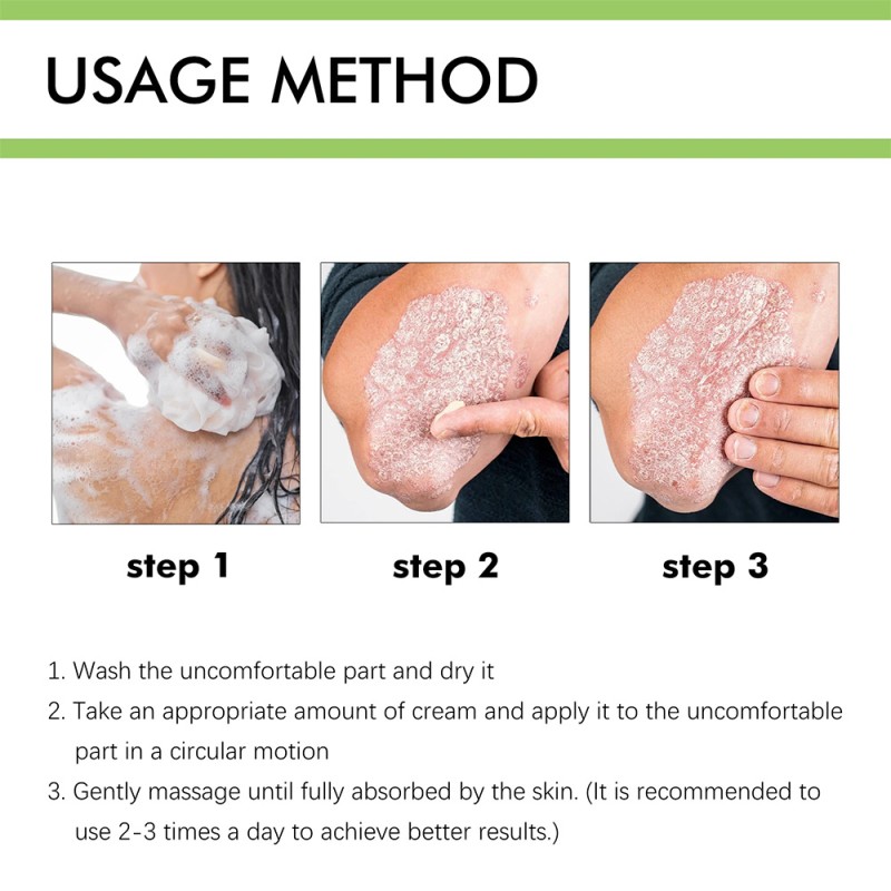 Psoriasis Cream Supplier - ZB 50g Herbal Anti-fungel Eczema Balm