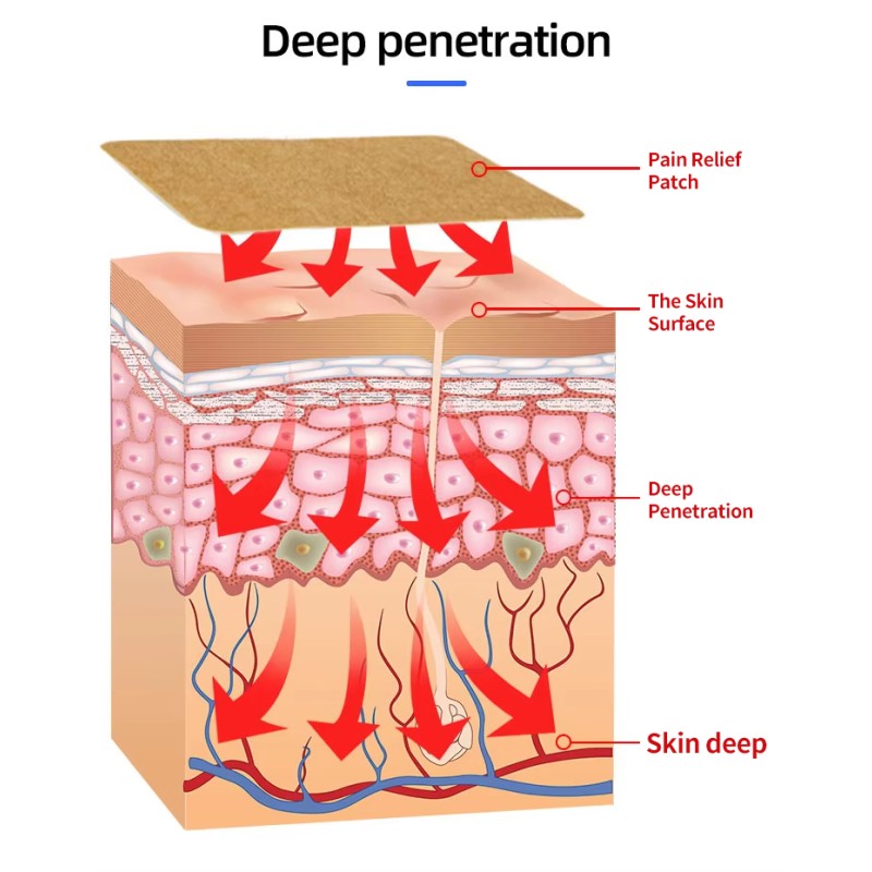 Muscle Pain Patch Factory - OEM Component Rehabilitation Therapy