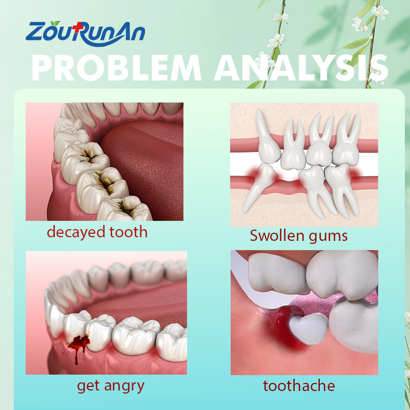 Nasal Spray Factory - 70ml Seawater Plant Extract Congestion Relief