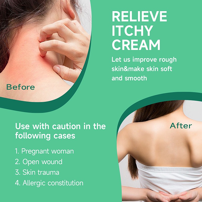 Skin Discomfort Cream Supplier - OEM Custom Grass Ointment Chinese Plaster