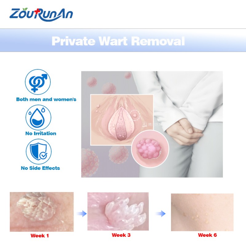 Oral Care Spray Supplier - 20g Safe Ingredients Gentle Discomfort Relief Spray