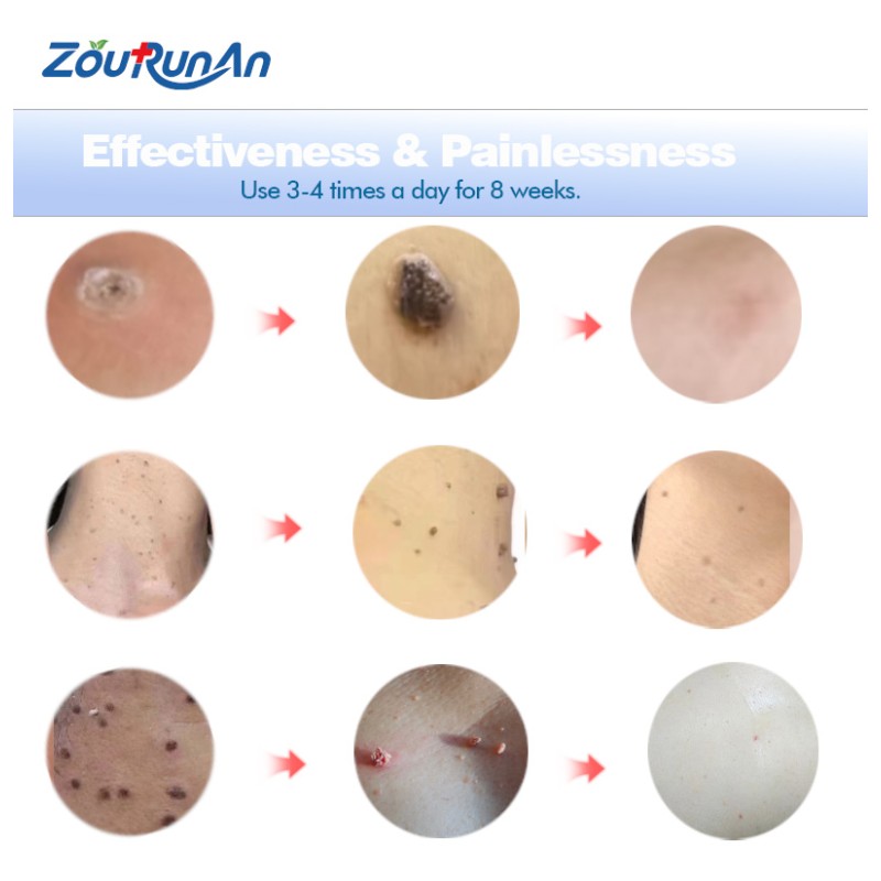 Oral Care Spray Supplier - 20g Safe Ingredients Gentle Discomfort Relief Spray