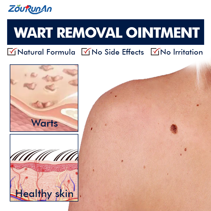 Natural Nasal Spray Supplier - 70ml Purified Seawater Plant Actives Mist