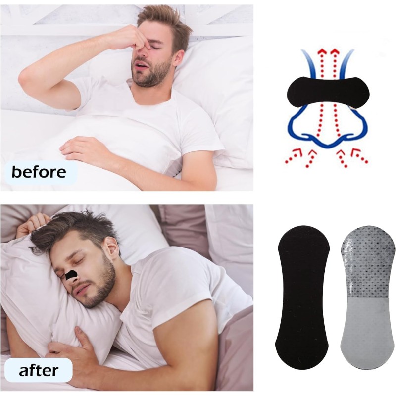 Mouth Breathing Tape Supplier - Hot Sale Better Sleep Snoring Relief