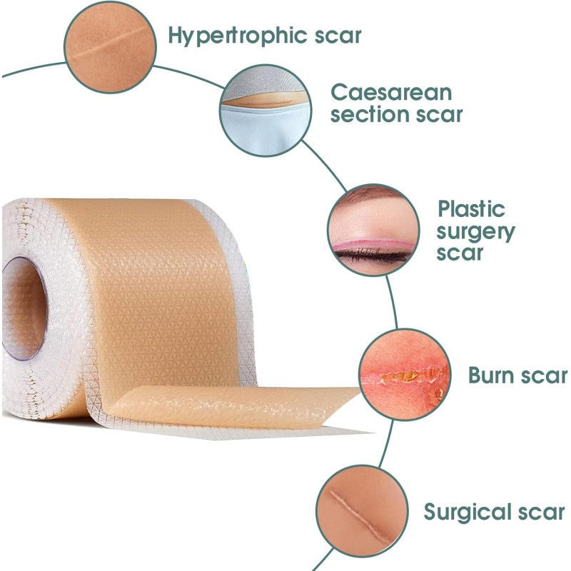 Scar Recovery Tape Factory - Factory Wholesale Cheap Price Silicone