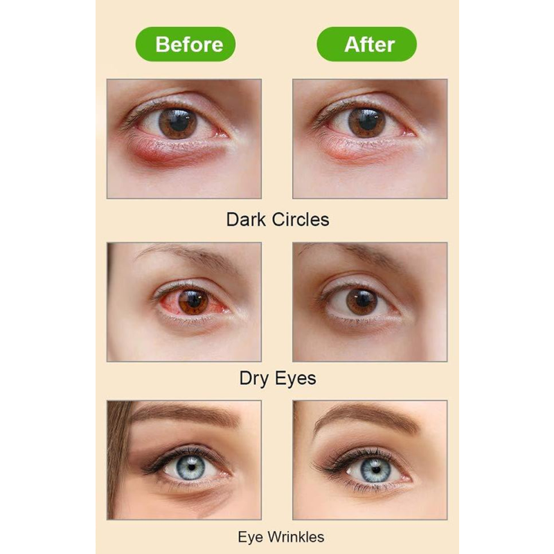 Steam Eye Mask Factory - OEM Disposable Relaxing Home Sleeping