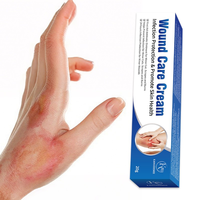 Burn Ointment Manufacturer - Effective Scald Wound Repair Anti-Infection