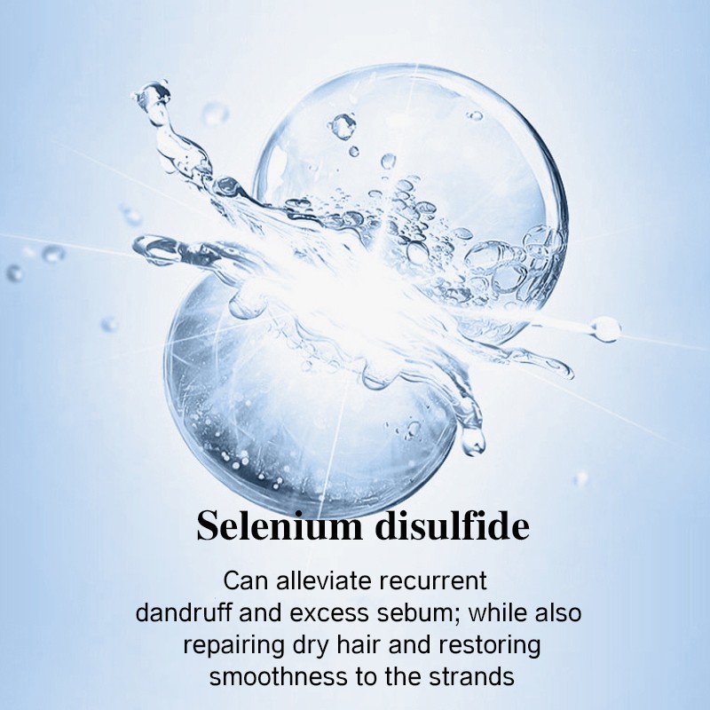 Anti-Dandruff Shampoo Manufacturer - Custom Selenium Sulfide Oil Control Shampoo