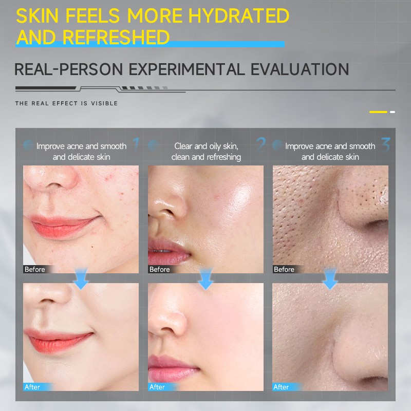 Facial Cleanser Supplier - Custom Nicotinamide Whitening Pore Cleansing Wash