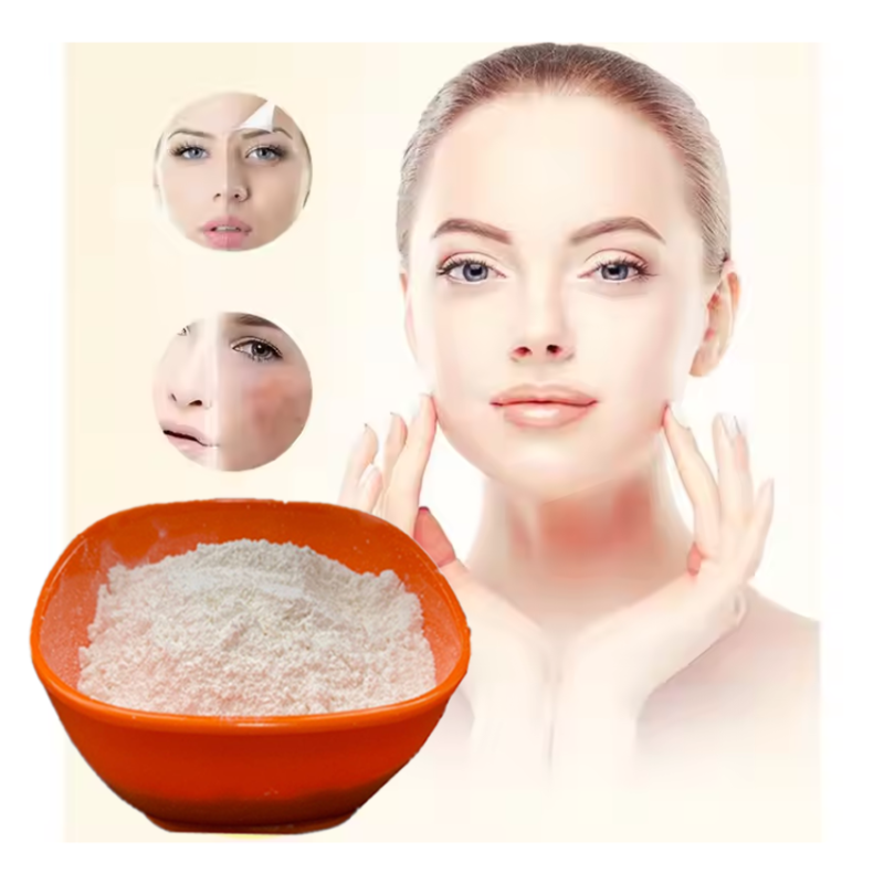 Sodium Cocoyl Isethionate Factory - OEM 85% Shampoo Sci Powder