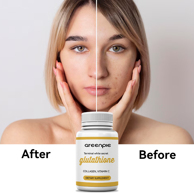 Glutathione Capsules Supplier - OEM Skin Whitening Soft Capsules