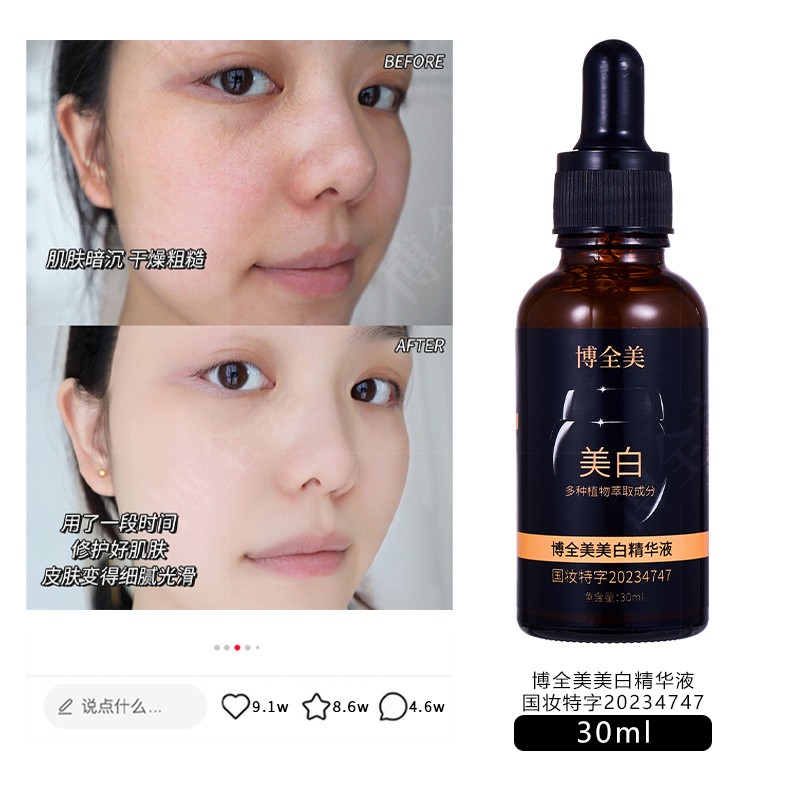 Skin Care Essence Supplier - OEM Whitening Freckle Moisturizing Care