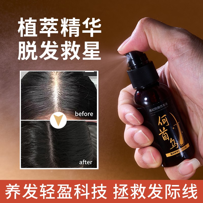 Ginger Hair Liquid Manufacturer - OEM Natural Herbal Loss Treatment