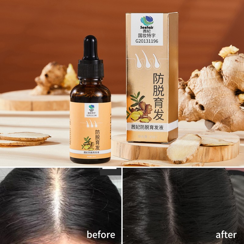 Ginger Hair Liquid Supplier - OEM 30ml Herbal Treat Hair Loss
