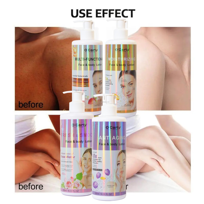 Whitening Lotion Manufacturer - Pigment Removal 500ml Dark Skin