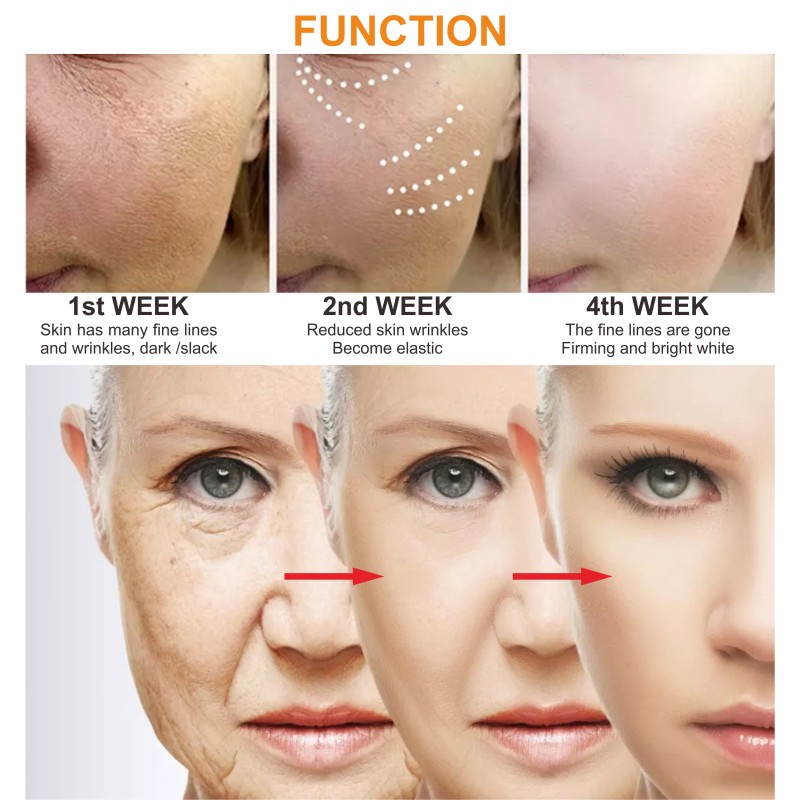 Face Serum Manufacturer - Anti-aging Niacinamide 1 Litre