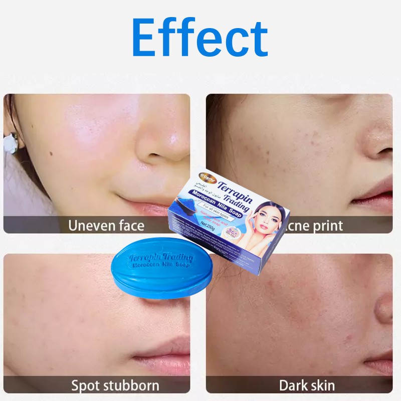 Whitening Soap Factory - Orange Anti-Acne Reshaping 250g