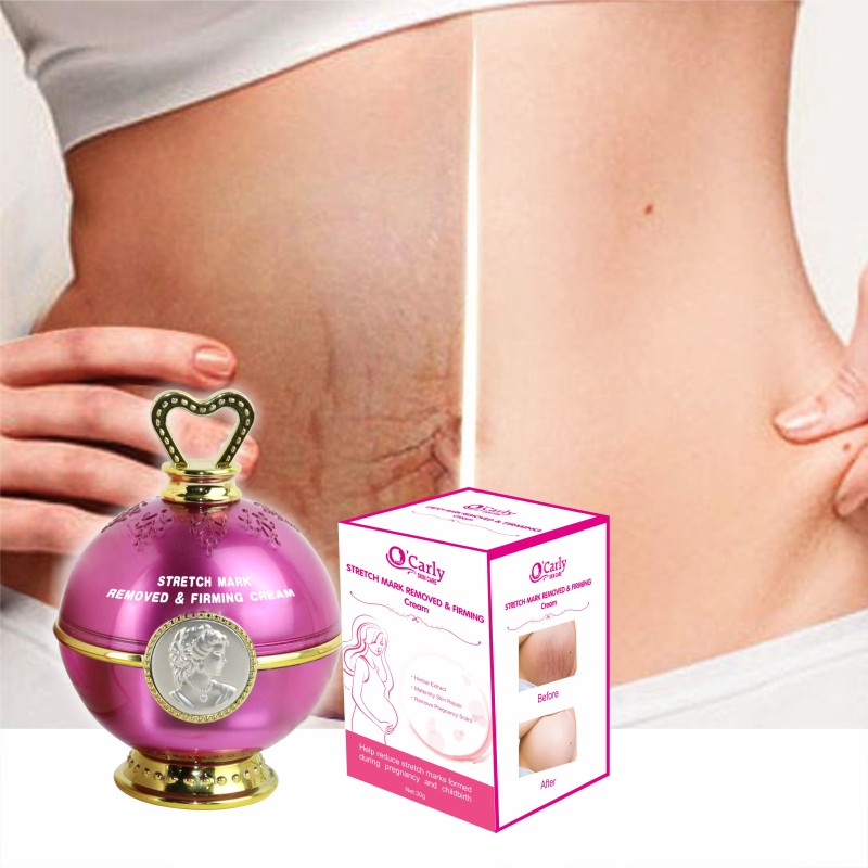 Stretch Mark Set Supplier - Rose Oil Cream Removal OEM