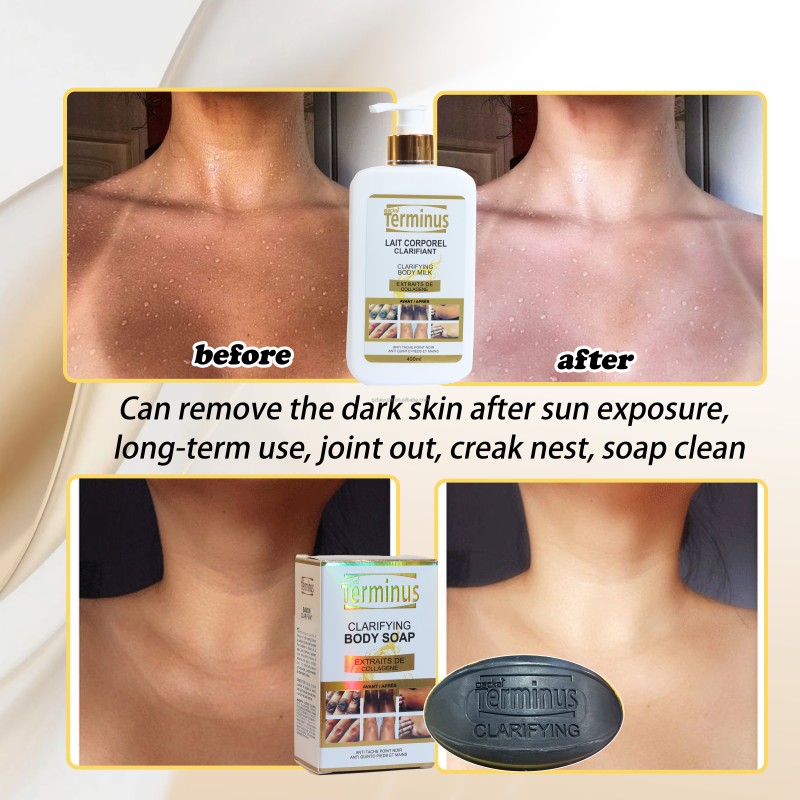 Body Lotion Supplier - Kojic Acid Dark Skin Removal