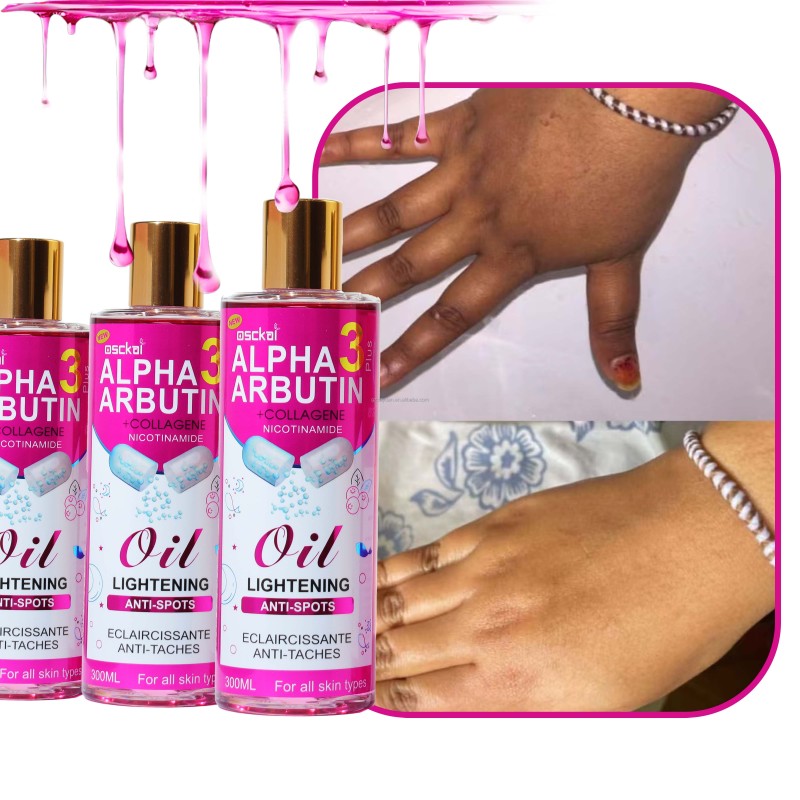 Whitening Oil Factory - Alpha Arbutin Vitamin E Collagen