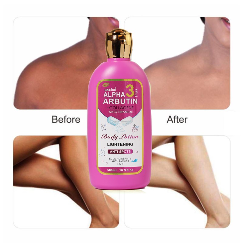 Brightening Lotion Factory - Kojic Acid Dark Spot Corrector