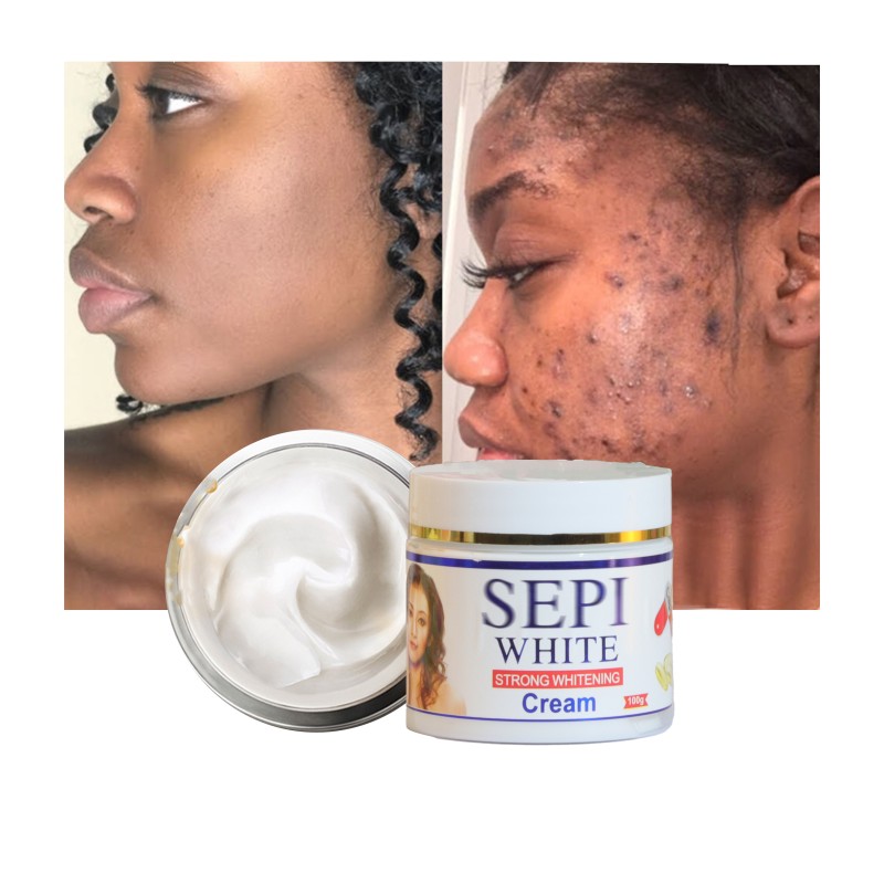 Face Cream Manufacturer - Wrinkle Dark Spot Removing Pimples