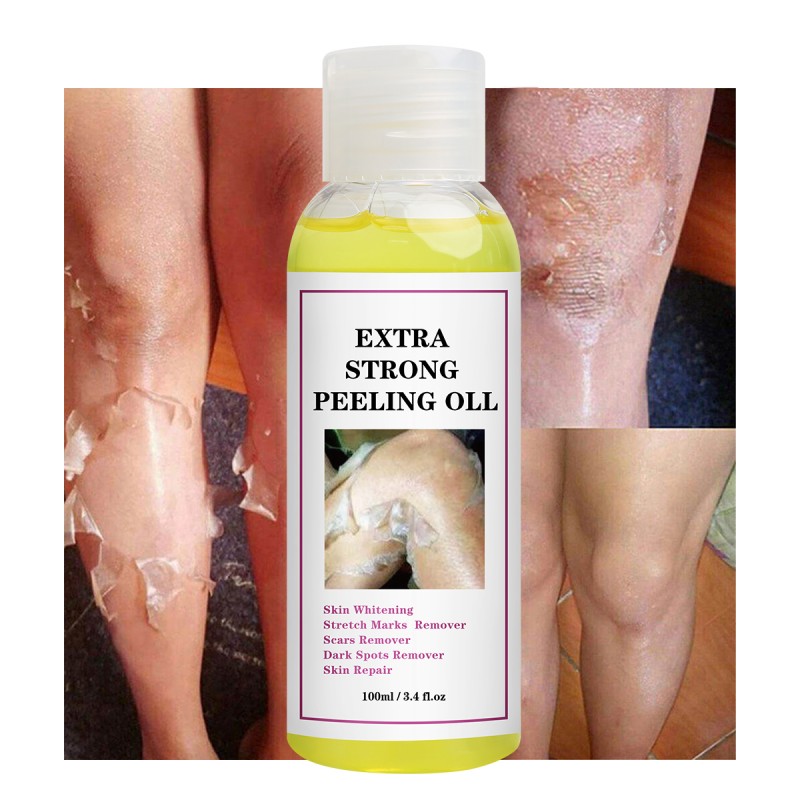 Face Care Oil Supplier - Extra Strong Peeling Vitamin C