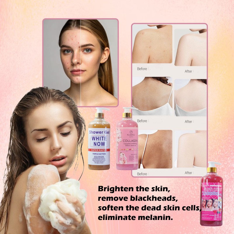 Body Wash Supplier - Whitening Cleansing 1000ml Rough Skin